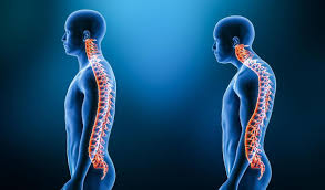rugpijn door verkeerde houding