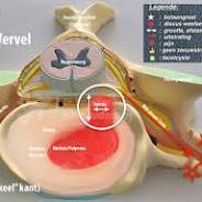 nekpijn hernia