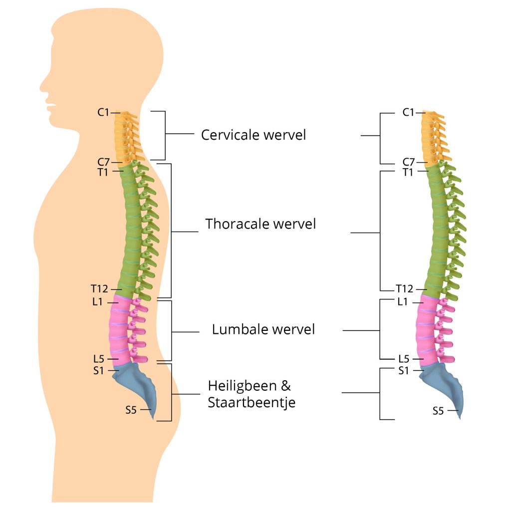 hernia lage onderrug