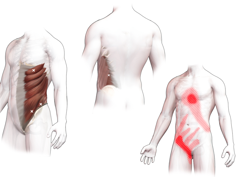 pijnlijke botten en spieren