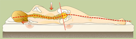 rugklachten na slapen