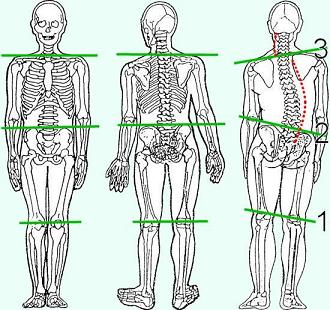 rugklachten onderrug