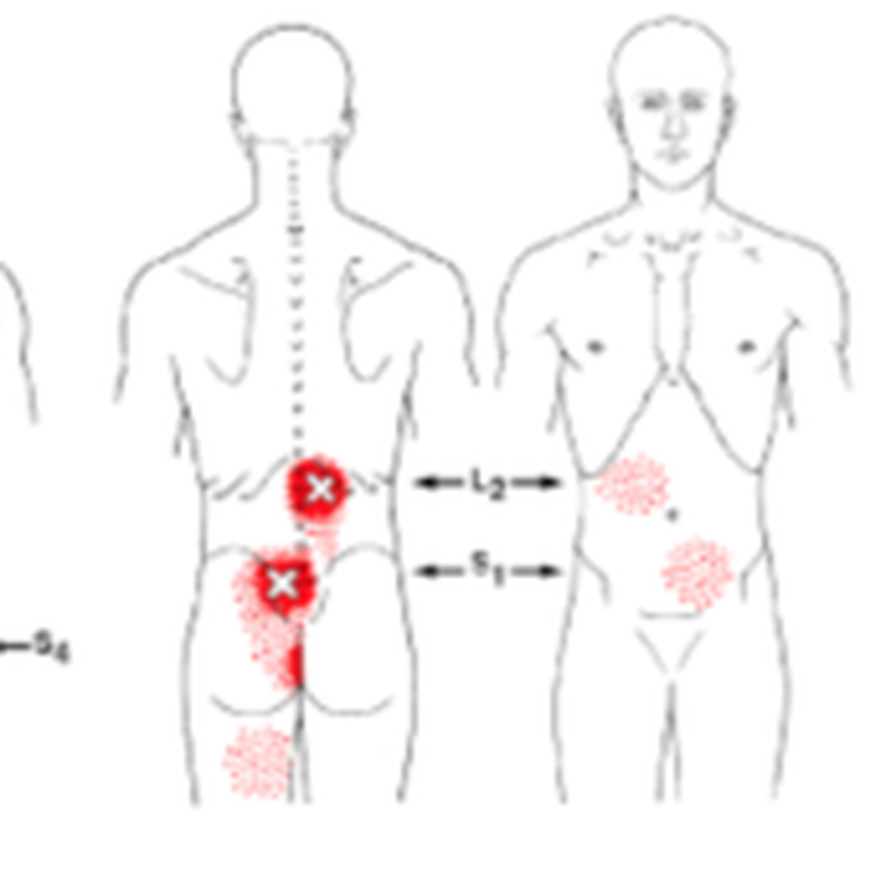 veel last van onderrug