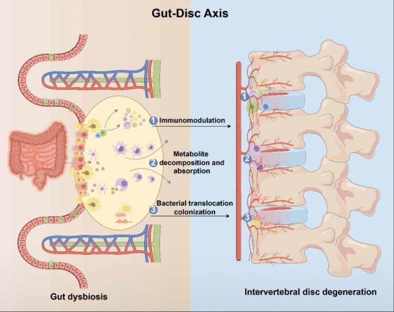 pijn in darmen en onderrug