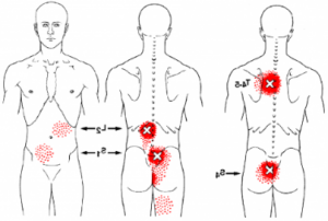 pijn in onderrug bij lopen