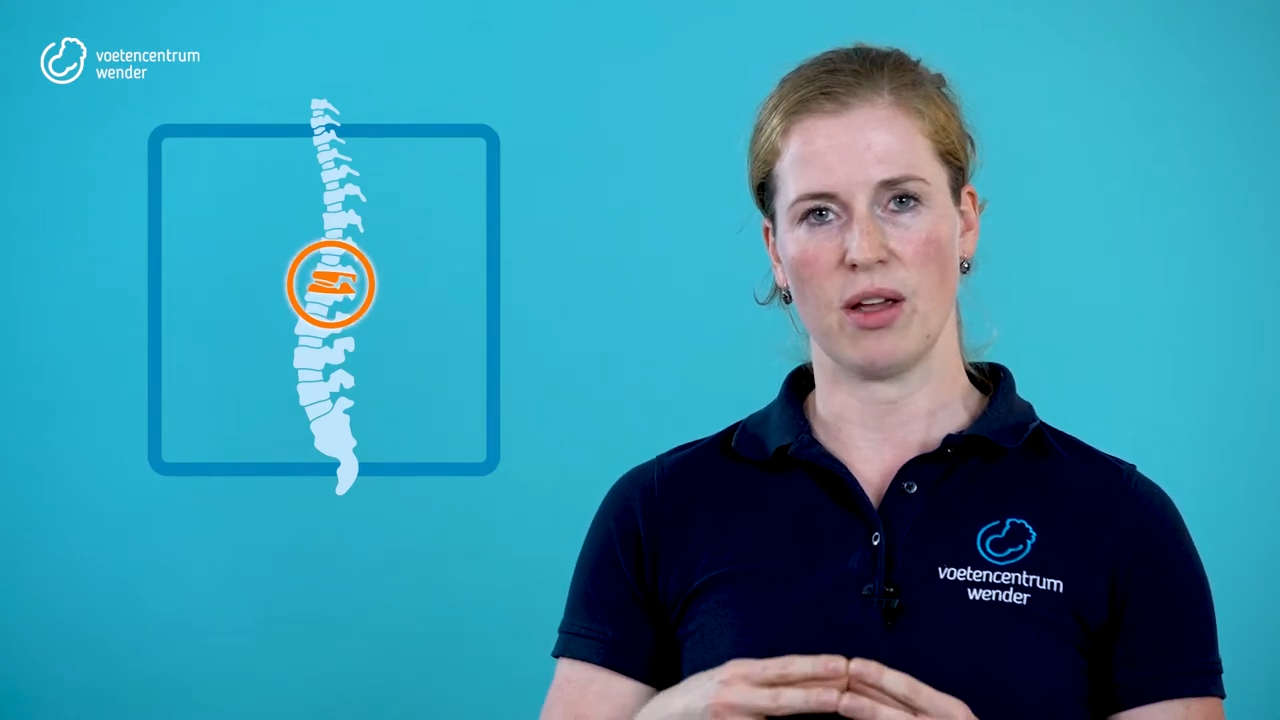 behandeling artrose rug